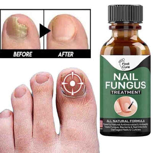 Fast Nail Fungal Treatment Serum Main image