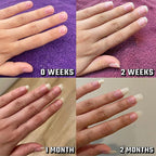 Radiant Nail Growth Oil Pen
